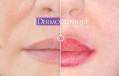 Détails : maquillage permanent Dermoclinique